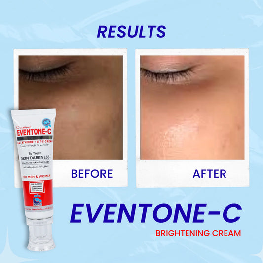 Eventone C Cream (Skin Glowing Cream)